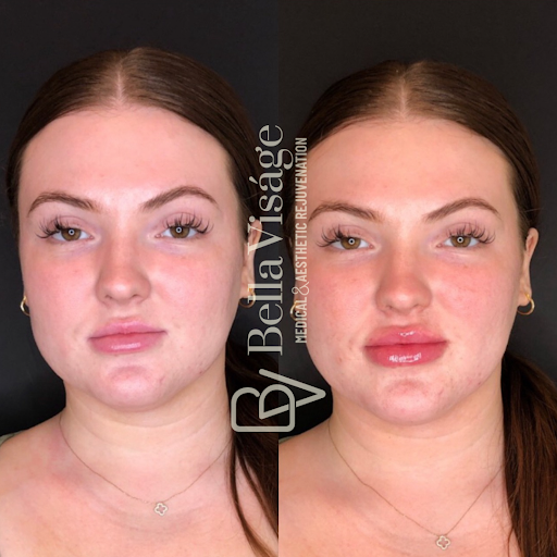 Explore cherry blossom tree tattoo ideas, creative tattoo ideas in Lakeland, available at Bella Visge Medical & Aesthetic Rejuvenation