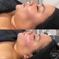 Tatum Skin - Photo 2 - Car repair in Inglewood, CA, Inglewood