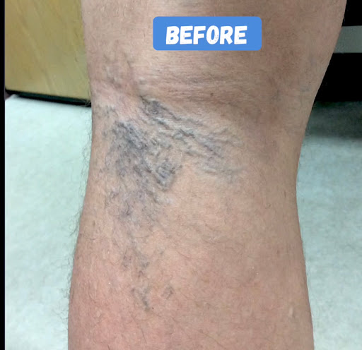 Explore atom tattoo ideas, creative tattoo ideas in Lake Oswego, available at Lake Oswego Vein and Aesthetic LOVA