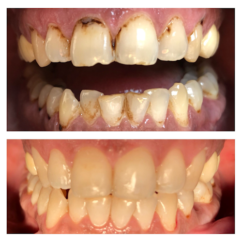 Blu Dental Clinica stomatologica Voluntari - Dentist