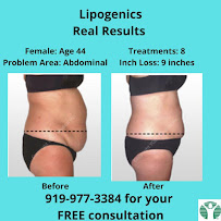 Physicians WEIGHT LOSS Centers - Photo 5 - Car repair in Raleigh, NC, Raleigh