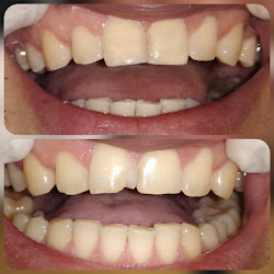 Consultório Odontológico ProSorrir - Dentista