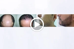 Neopel Hair Clinic image