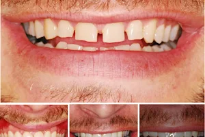 Οδοντίατρος Θεσσαλονίκη Dental Laser Γιώργος Τούμα image