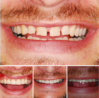 Οδοντίατρος Θεσσαλονίκη Dental Laser Γιώργος Τούμα