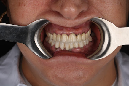 فكرة عيادة الأسنان - idea dental clinic