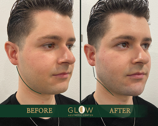 Glow Aesthetic Center Encino image