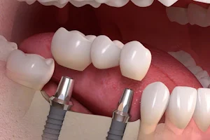 Silicon Valley Dental Center image