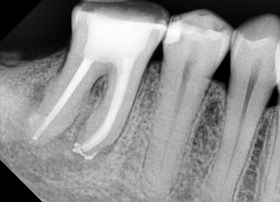 Endodontológus
