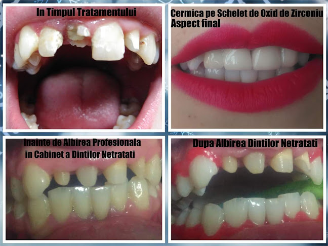 Opinii despre Cabinet Stomatologic Dr. Parscuta Voicu în <nil> - Dentist