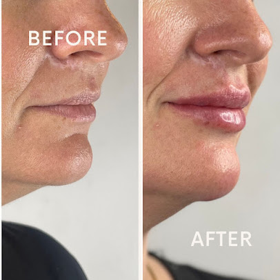 جماليات لندن المملكة المتحدة - Aesthetics London UK