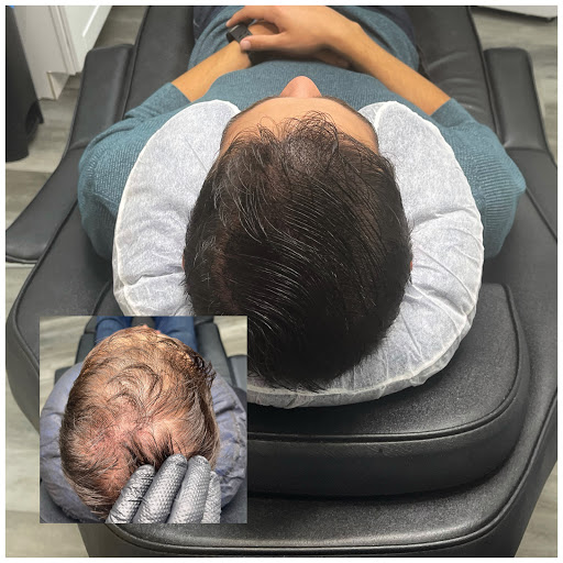 Explore mic tattoo ideas, creative tattoo ideas in Roseville, available at NuHair Ink. Scalp MicroPigmentation & Aesthetic Clinic of Sacramento