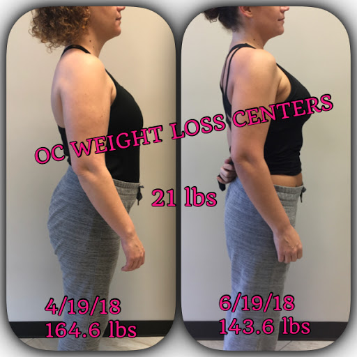 OC Weight Loss Centers & CoolSculpting image