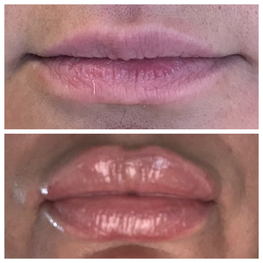 Explore wrap tattoo ideas, creative tattoo ideas in Eugene, available at Brighter Smiles Med Spa and Laser Center