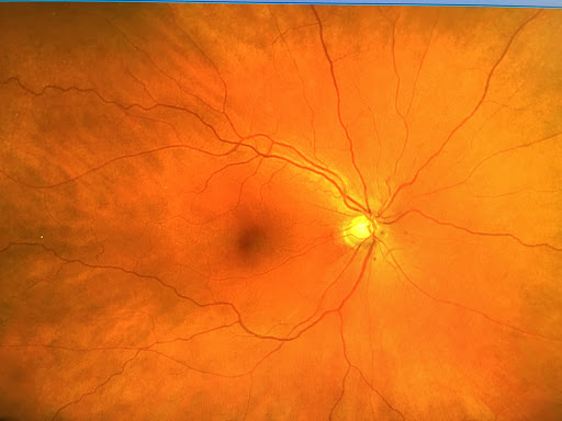 Optician «Optical Outlet», reviews and photos, 4048 Beechwood Blvd, Pittsburgh, PA 15217, USA