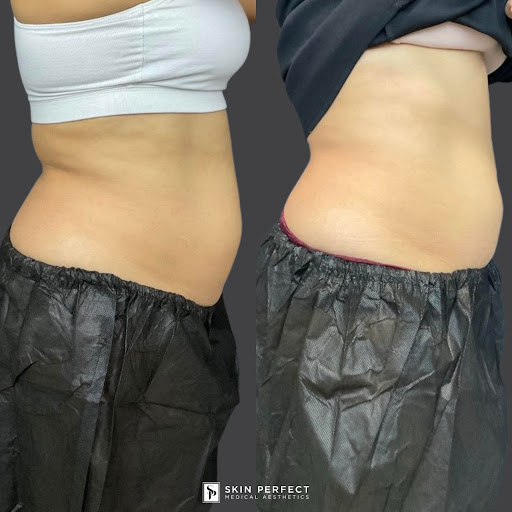 Explore raccoon tattoo ideas, creative tattoo ideas in Whittier, available at Skin Perfect Medical Aesthetics