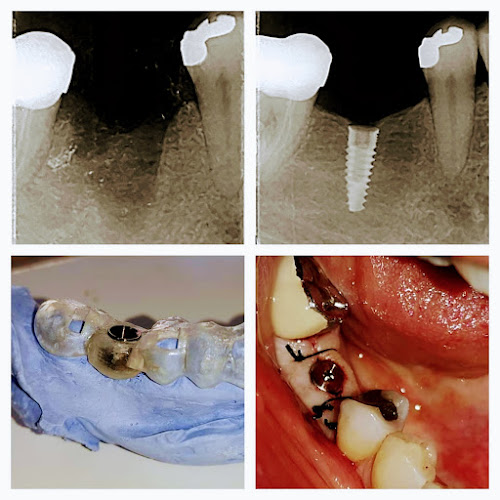 Ζαρίφη 14, Συκιές 566 25