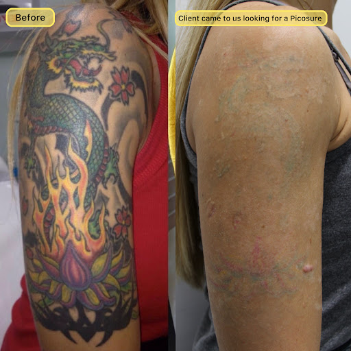 Explore dad tattoo ideas, creative tattoo ideas in New York, available at Ag2g Laser Tattoo Removal & MedSpa