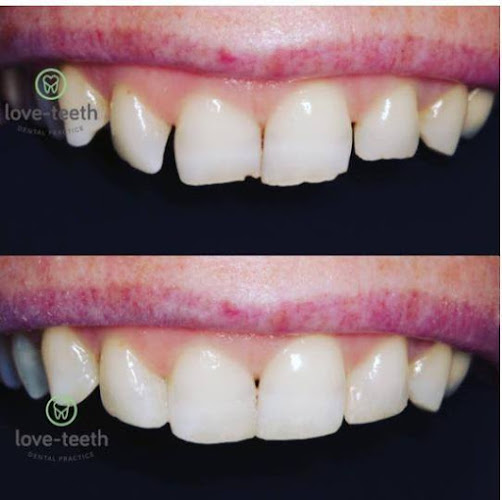 Reviews of Love-Teeth Dental Practice in Manchester - Dentist
