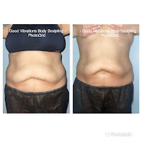 Good Vibrations Body Sculpting - Photo 9 - Car repair in Pasadena, CA, Pasadena