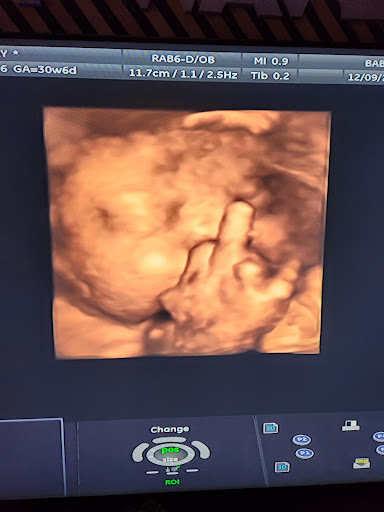 Baby Wave 4D Ultrasound image