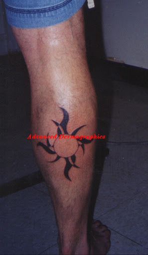 Tattoo Shop «Advanced Dermagraphics Tattoo», reviews and photos, 1132 E Pacific Coast Hwy, Long Beach, CA 90806, USA