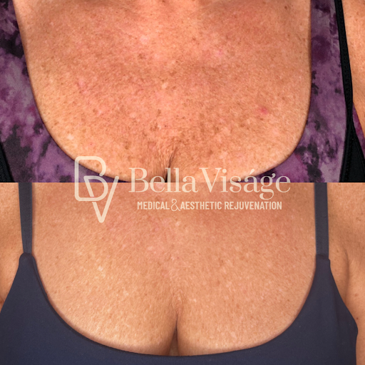 Explore black male tattoo ideas, creative tattoo ideas in Lakeland, available at Bella Visge Medical & Aesthetic Rejuvenation