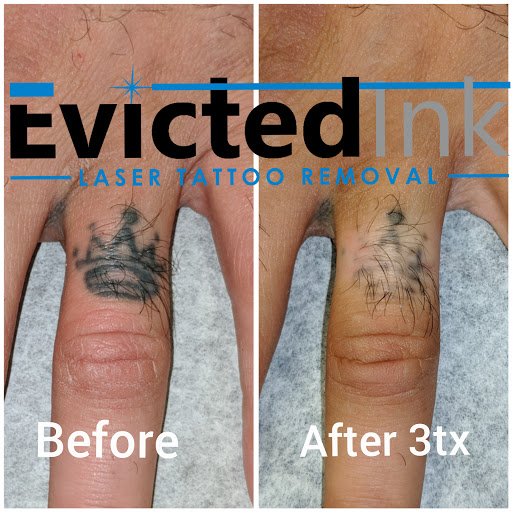 Explore the hobbit tattoo ideas, creative tattoo ideas in Wichita, available at Evicted Ink Laser Tattoo Removal
