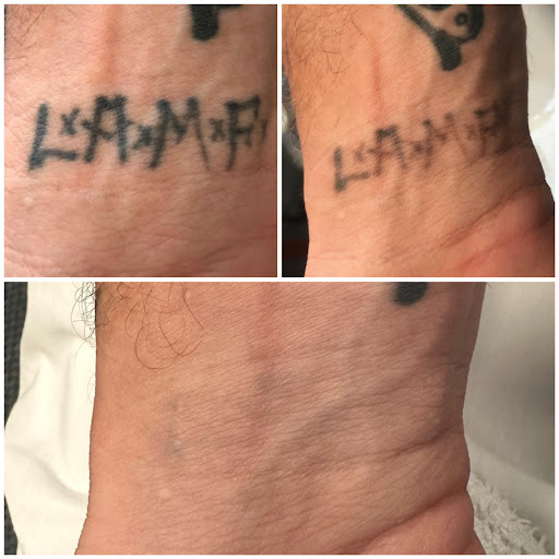 Explore small egyptian tattoo ideas, creative tattoo ideas in San Antonio, available at MEDermis Tattoo Removal