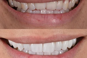 Beverly Hills Dentistry image