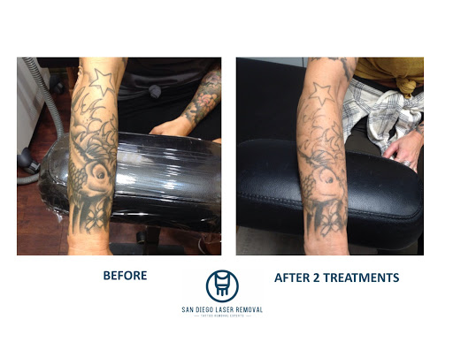 Explore legend of korra tattoo ideas, creative tattoo ideas in San Diego, available at Removery Tattoo Removal & Fading