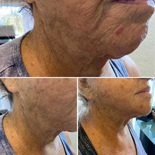 Massage Spa «Refined Beauty Day Spa», reviews and photos, 7440 Wiles Rd, Coral Springs, FL 33067, USA