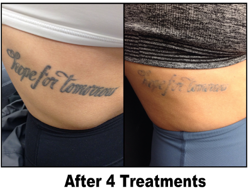 Find trinity knot tattoo ideas for your next unique tattoo in King Of Prussia at Inkaway Laser Tattoo Removal