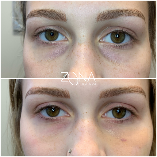 Skin Care Clinic «ZONA MED SPA», reviews and photos, 9767 N 91st St #102, Scottsdale, AZ 85258, USA