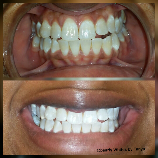 Pearly Whites By Tanya