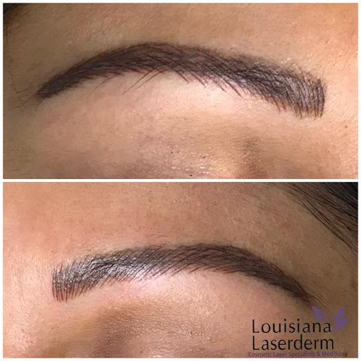 Explore tattoo ideas for soulmates, creative tattoo ideas in Baton Rouge, available at Louisiana Laserderm