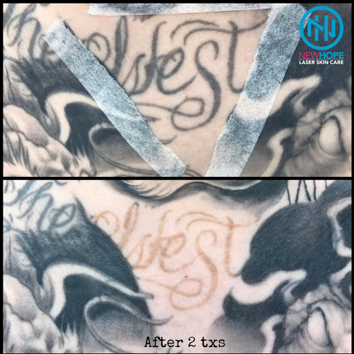 Explore rock music tattoo ideas, creative tattoo ideas in Westminster, available at Newhope Laser Skin Care