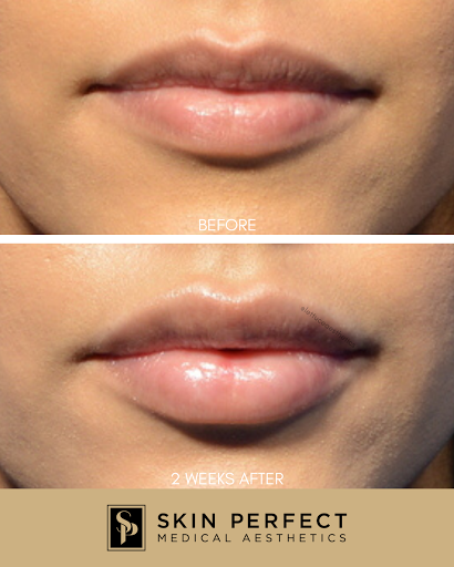Skin Perfect Medical Aesthetics - Glendora image