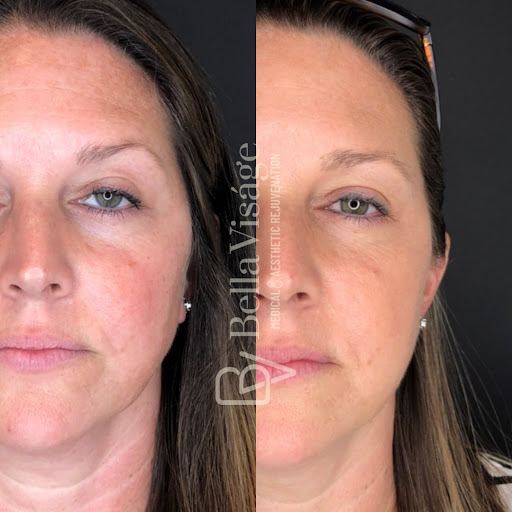 Explore warrior sleeve tattoo ideas, creative tattoo ideas in Lakeland, available at Bella Visge Medical & Aesthetic Rejuvenation