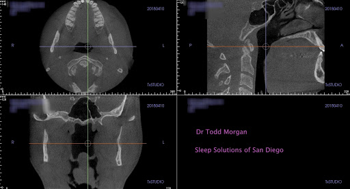 Sleep Solutions of San Diego