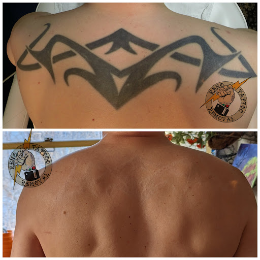 Explore non binary tattoo ideas, creative tattoo ideas in Reno, available at Reno Tattoo Removal