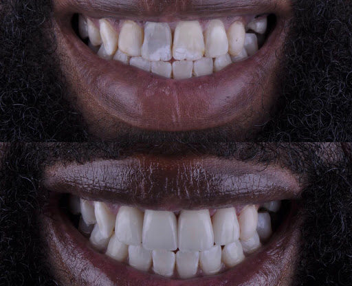 Smile Design Center Dentist In Croton on Hudson NY Implant Dentist image 1