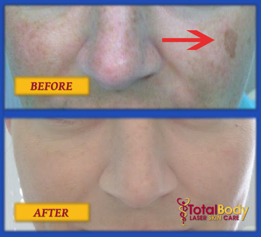 Explore sticker sleeve tattoo ideas, creative tattoo ideas in Brookfield, available at Total Body Laser & Med Spa