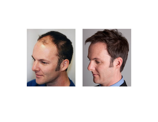 Hair Transplantation Clinic «Bosley Medical - Kansas City», reviews and photos, 460 Nichols Rd #350, Kansas City, MO 64112, USA