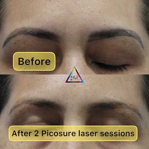 Explore nc tattoo ideas, creative tattoo ideas in New York, available at Ag2g Laser Tattoo Removal & MedSpa