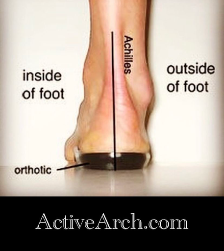 Orthotics ( Custom Molded Foot Prescription Insoles Arch Support) - order online ActiveArch.com image 8