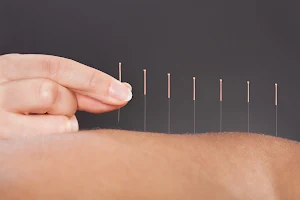Equilibrium Acupuncture image