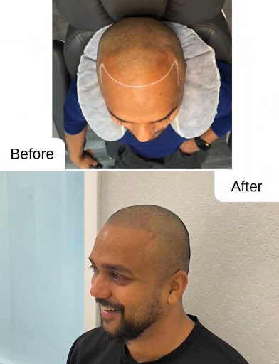 Explore matching cousin tattoo ideas, creative tattoo ideas in Roseville, available at NuHair Ink. Scalp MicroPigmentation & Aesthetic Clinic of Sacramento