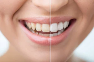 Emrancare dental image