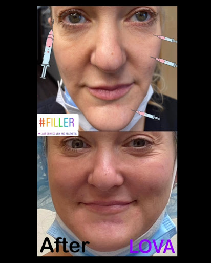 Explore sun moon star tattoo ideas, creative tattoo ideas in Lake Oswego, available at Lake Oswego Vein and Aesthetic LOVA